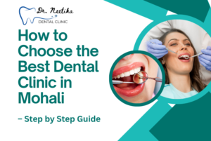 How to Choose the Best Dental Clinic in Mohali – Step by Step Guide