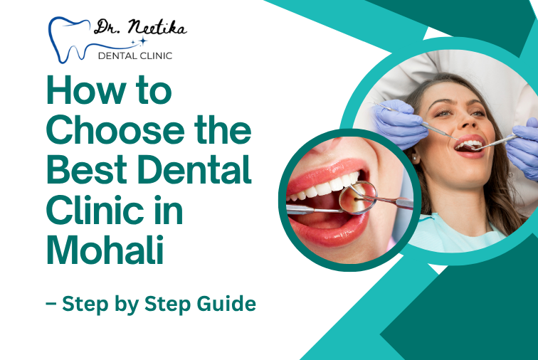 How to Choose the Best Dental Clinic in Mohali