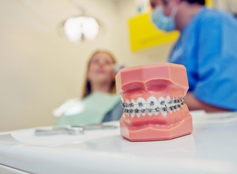 Braces treatment in Mohali for teeth alignment