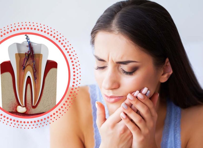 Pain free root canal at Dr Neetika Dental Clinic
